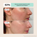 Canopy Faucet Filter with Micro Mesh and Activated Carbon Block