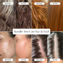 Canopy Filtered Tool-Free Showerhead with Felt Diffuser