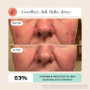 Canopy Large Room Humidifier Aroma Diffuser with UV Light for Large Spaces