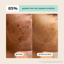 Canopy Filtered Tool-Free Showerhead with Felt Diffuser